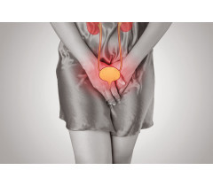 Infection urinaire, cystite