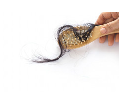 Perte de cheveux